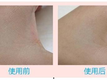 自体性欲,揭秘自我愉悦的奥秘